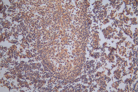 TK1 Recombinant Monoclonal Antibody