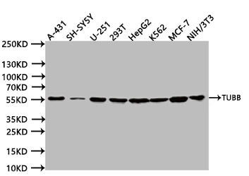 TUBB Recombinant Monoclonal Antibody