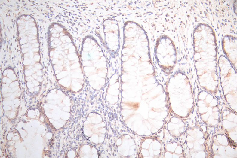 UBE2C Recombinant Monoclonal Antibody