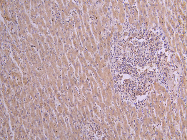 VEGFA Recombinant Monoclonal Antibody
