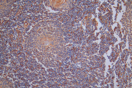 VIM Recombinant Monoclonal Antibody