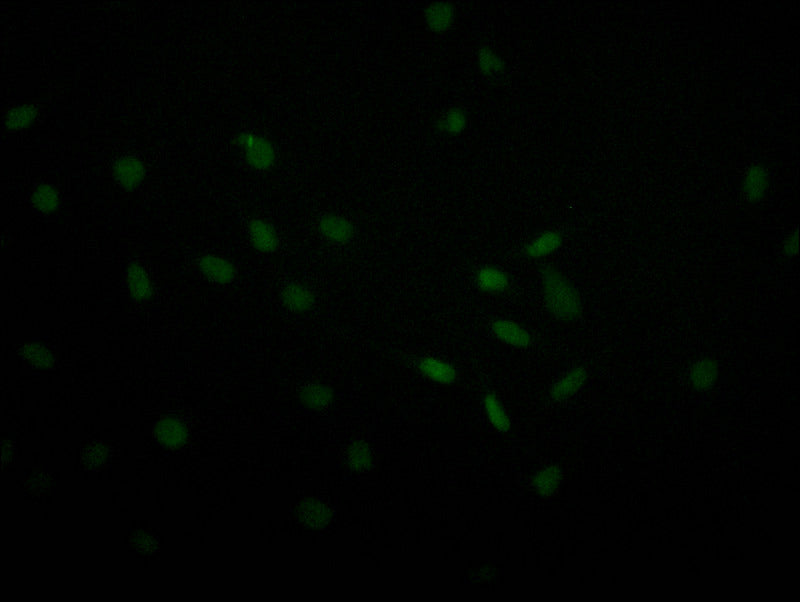 USP22 Recombinant Monoclonal Antibody