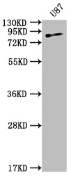 TGM2 Antibody