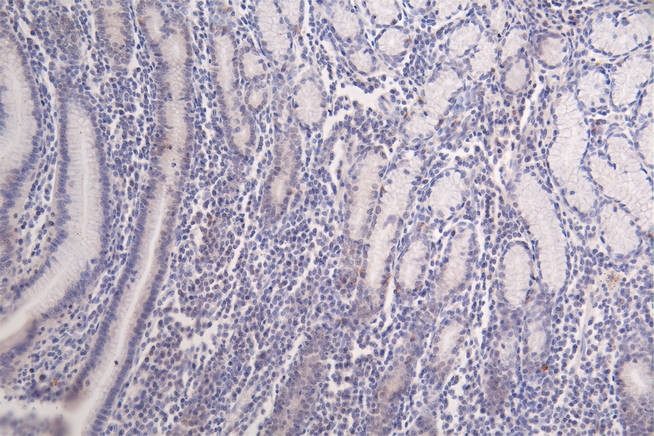 Formyl-HIST1H3A (K122) Recombinant Monoclonal Antibody