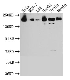ROCK2 Antibody