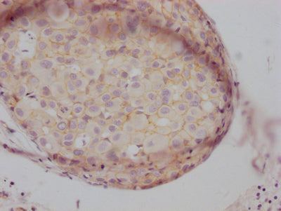 CTNNB1 Antibody
