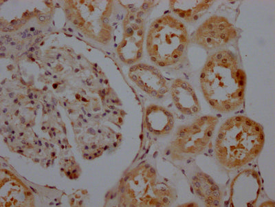SIRT5 Antibody