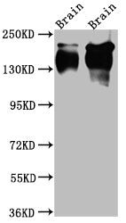 NTRK1 Antibody