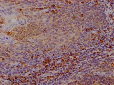 CTLA4 Antibody