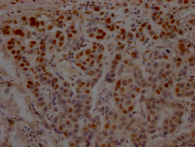TP53 Antibody