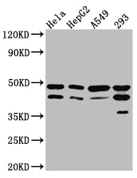 GSK3B Antibody