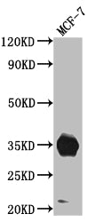 IGFBP2 Antibody