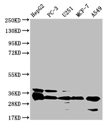 TMEM192 Antibody