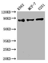 IKBKB Antibody