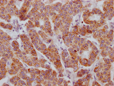 ACVR2B Antibody