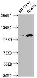 LGR5 Antibody