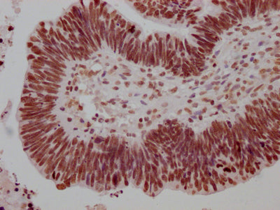 HSF1 Antibody