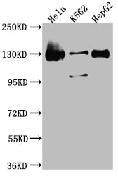 BUB1 Antibody