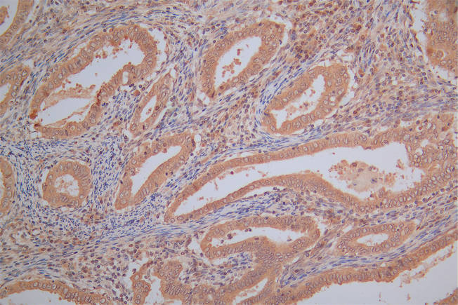 PRDX2 Recombinant Monoclonal Antibody