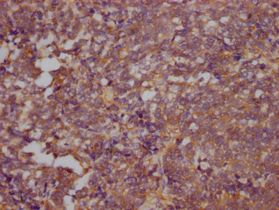 RHOA Antibody
