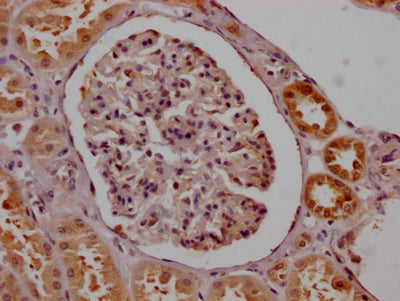 SMN1 Antibody