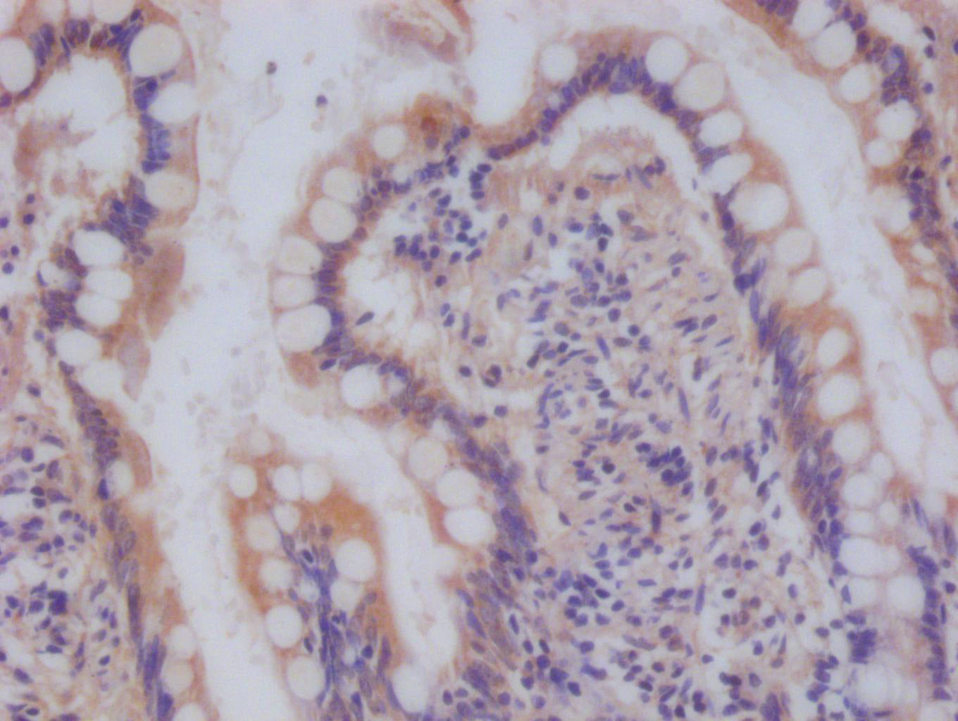 NDUFS4 Antibody