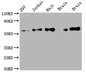 PAK2 Antibody