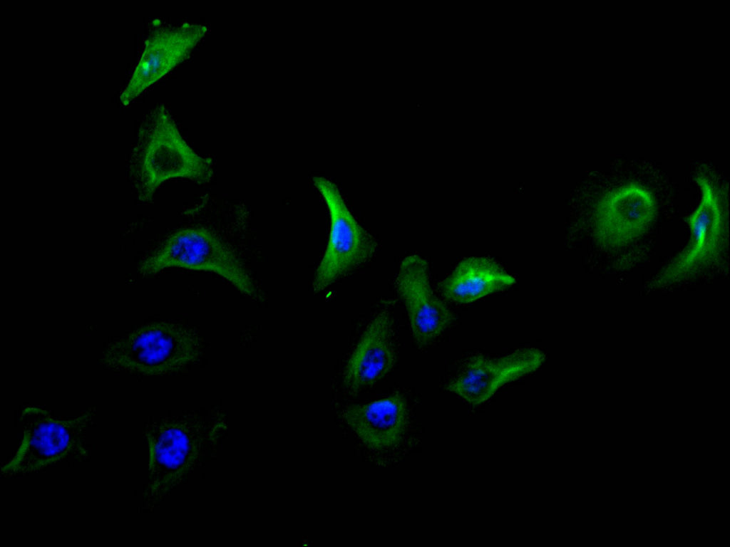 LY6E Recombinant Monoclonal Antibody