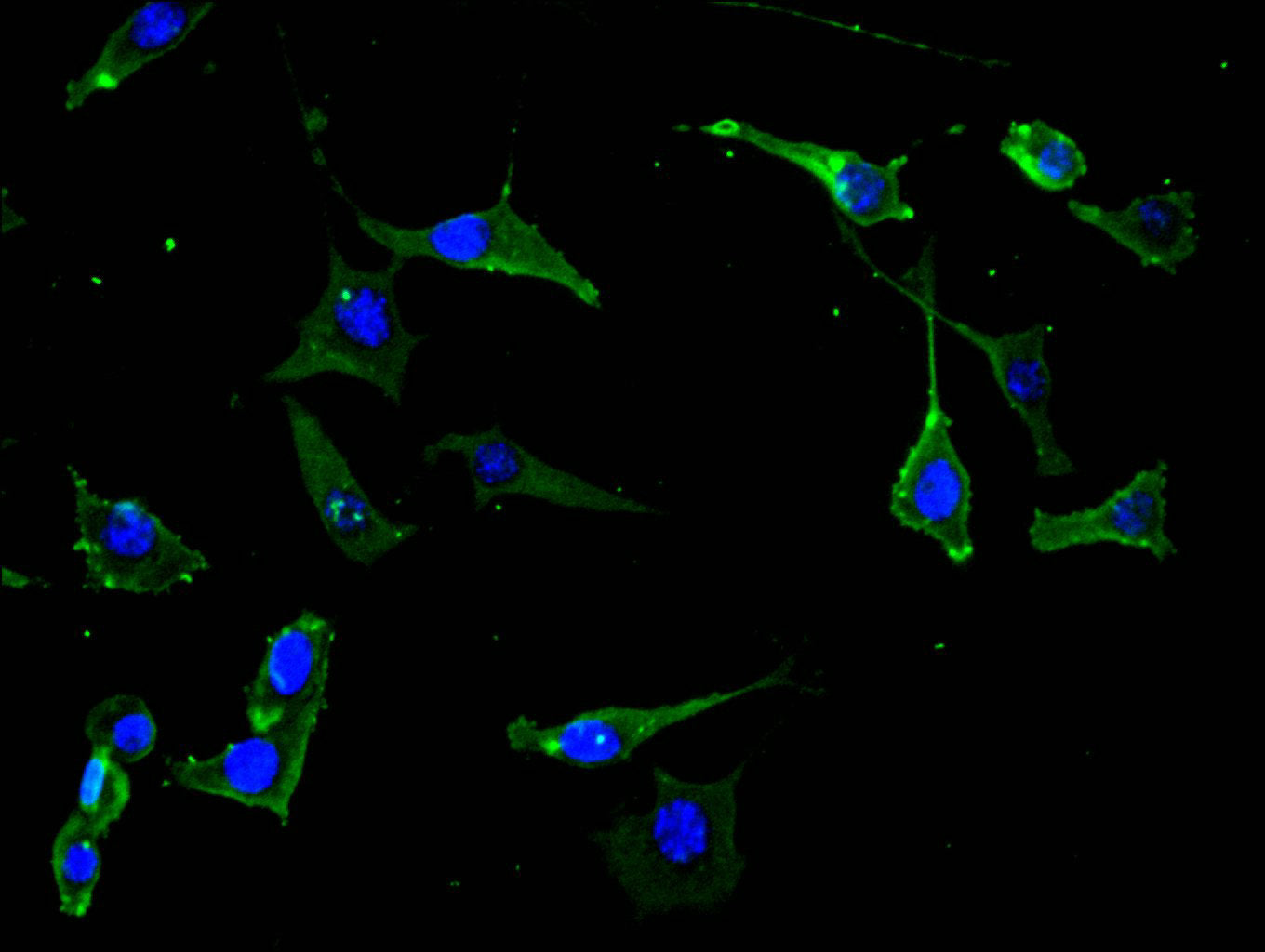 NTRK2 Recombinant Monoclonal Antibody