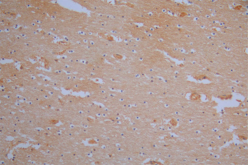 FSCN1 Recombinant Monoclonal Antibody