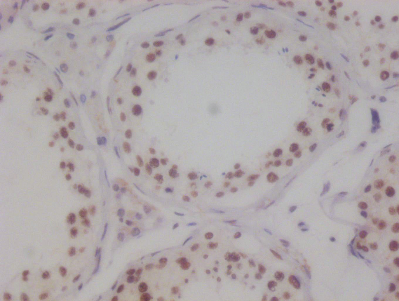 KAT8 Antibody
