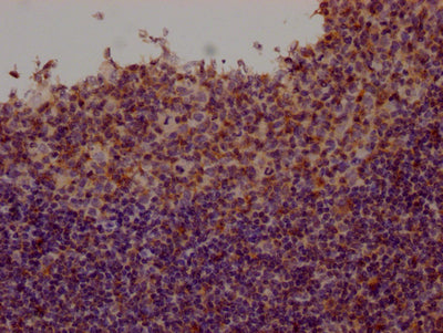 FYN Antibody