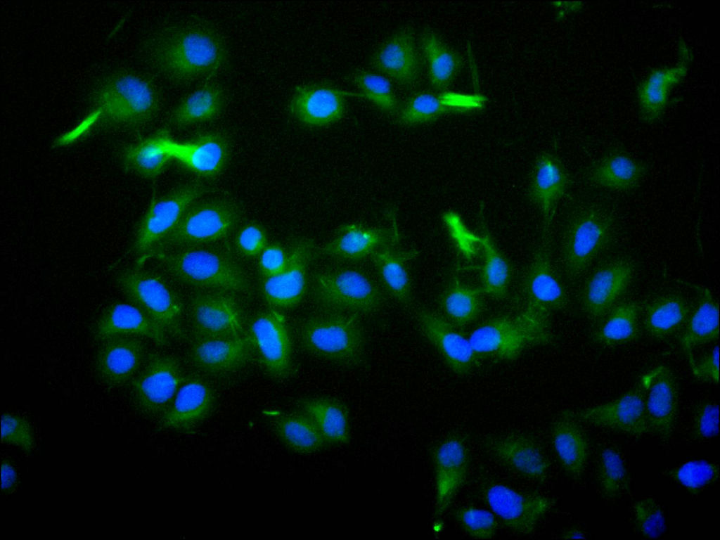 ILDR2 Recombinant Monoclonal Antibody