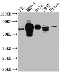 RPS6KB1 Antibody