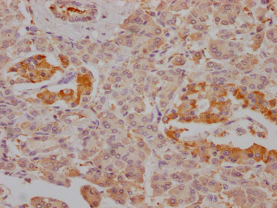 FBP1 Antibody