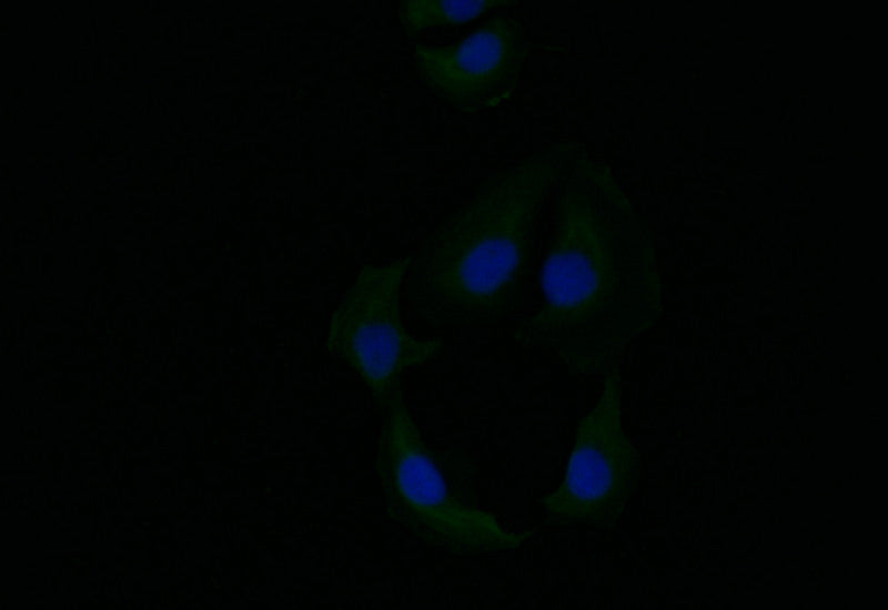 KRT6A Recombinant Monoclonal Antibody