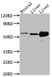 ALDH2 Antibody