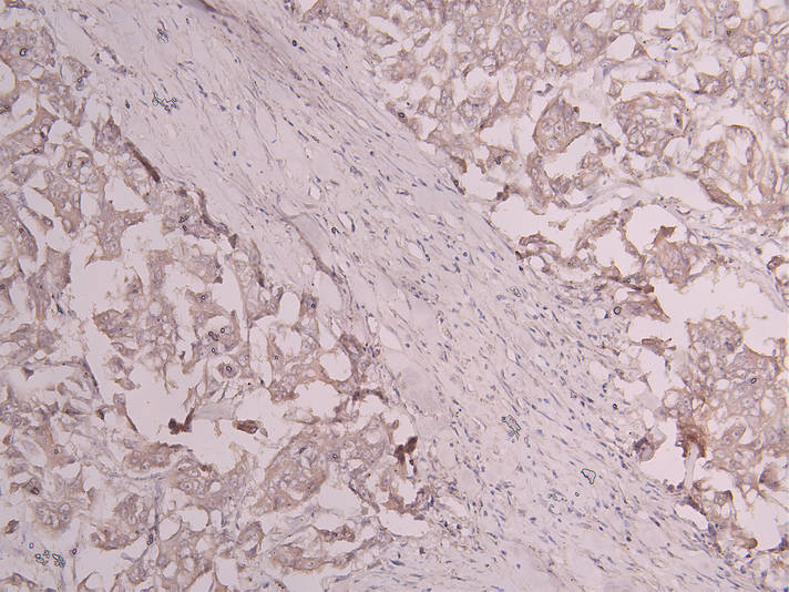 CD163 Recombinant Monoclonal Antibody