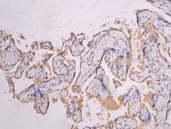 HTRA1 Recombinant Monoclonal Antibody