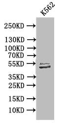 TUBB1 Recombinant Monoclonal Antibody