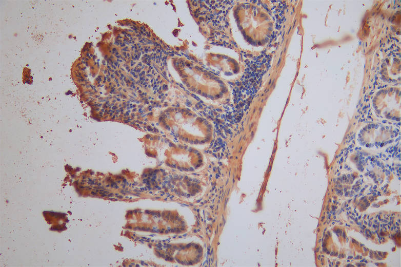XPNPEP1 Recombinant Monoclonal Antibody