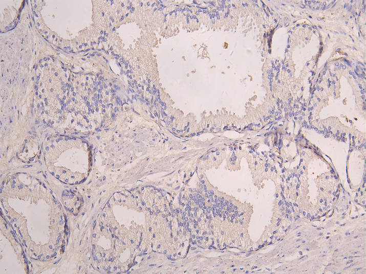 SIGLEC8 Recombinant Monoclonal Antibody
