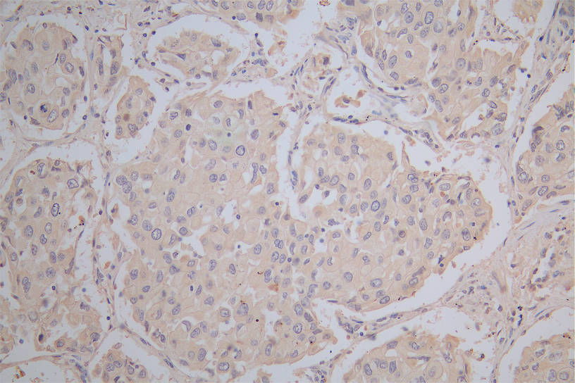 CD274 Recombinant Monoclonal Antibody