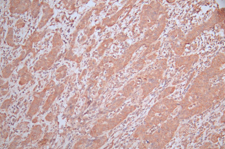 EDAR Recombinant Monoclonal Antibody