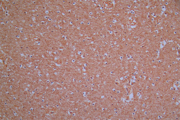ROBO1 Recombinant Monoclonal Antibody