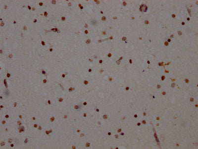 ADAR Antibody