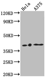 LPAR1 Antibody