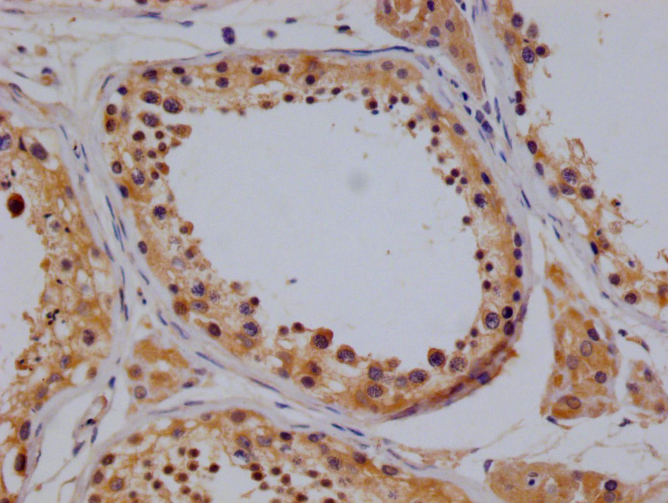 TBK1 Antibody