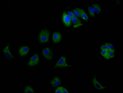 ERBB3 Antibody