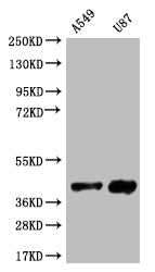 SRR Antibody